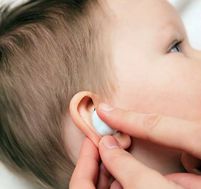 Как правильно чистить уши ребенку до года и старше от серы и других загрязнений?