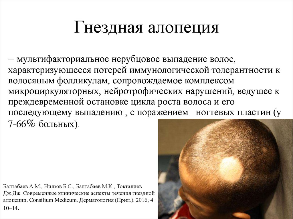 Алопеция: причины и лечение очагового и тотального облысения у детей, профилактика выпадения волос