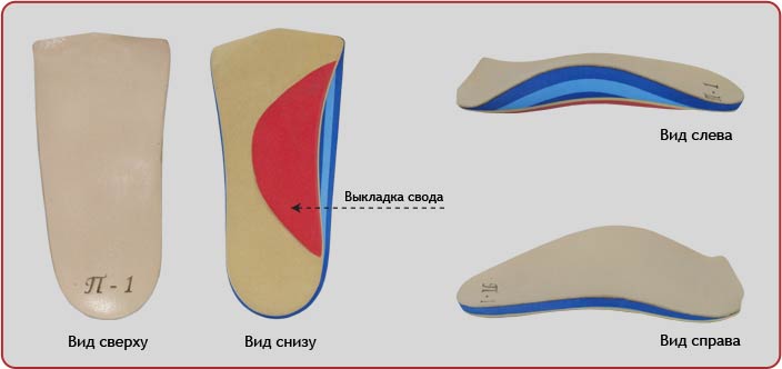 Ортопедические стельки для детей при плоскостопии: как подобрать обувь для здоровья стопы у подростков, профилактика плоскостопия