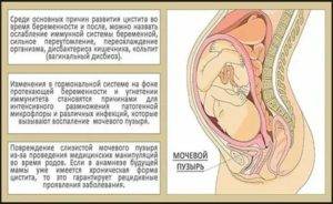 Боль слева внизу живота при беременности