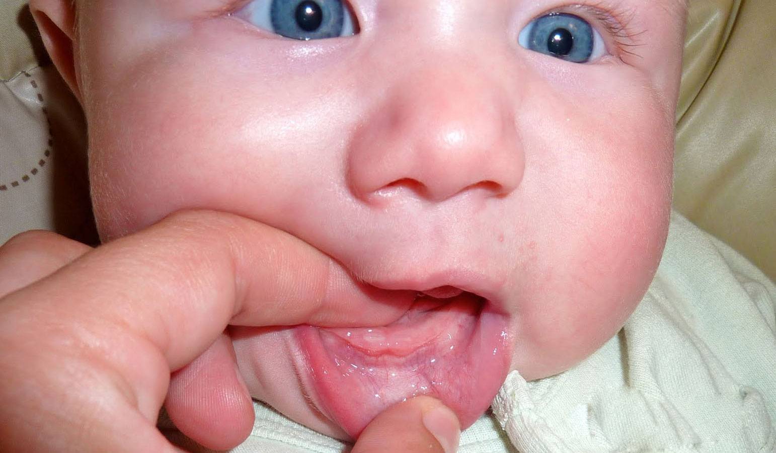 Появился насморк при прорезывании зубов у детей: нормальное явление или отклонение от нормы