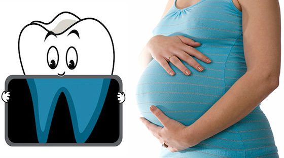 Опасно ли рентген-исследование в период беременности