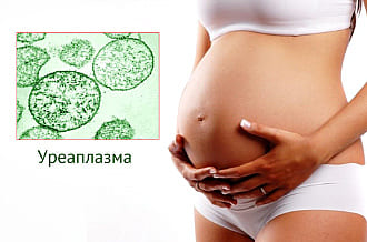 Можно ли забеременеть при уреаплазме, ее влияние на зачатие, когда планировать береенность после лечения уреаплазмоза, что делать, если забеременела с уреаплазмой