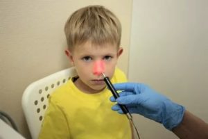 Лазеротерапия при аденоидах у детей
