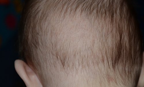 Плохо растут волосы у грудничка 8 месяцев. почему у ребёнка не растут волосы