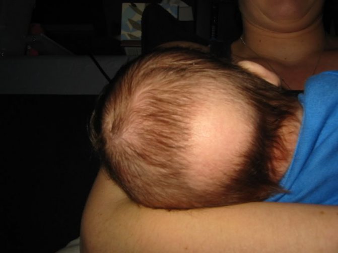 Как растут волосы у новорожденных на голове