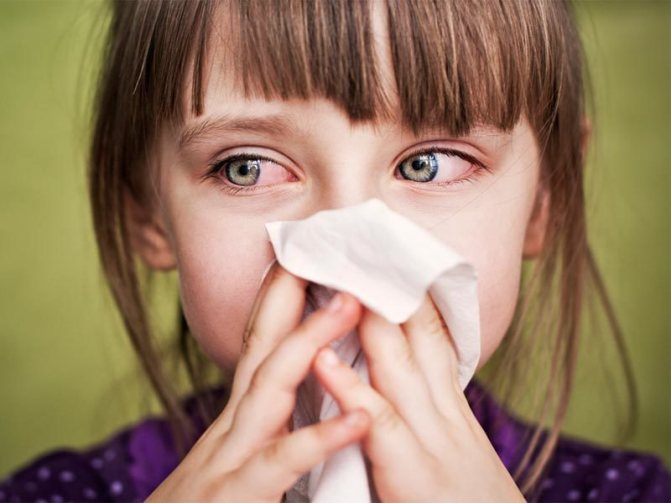 У ребенка при простуде гноятся глаза – причины и лечение
