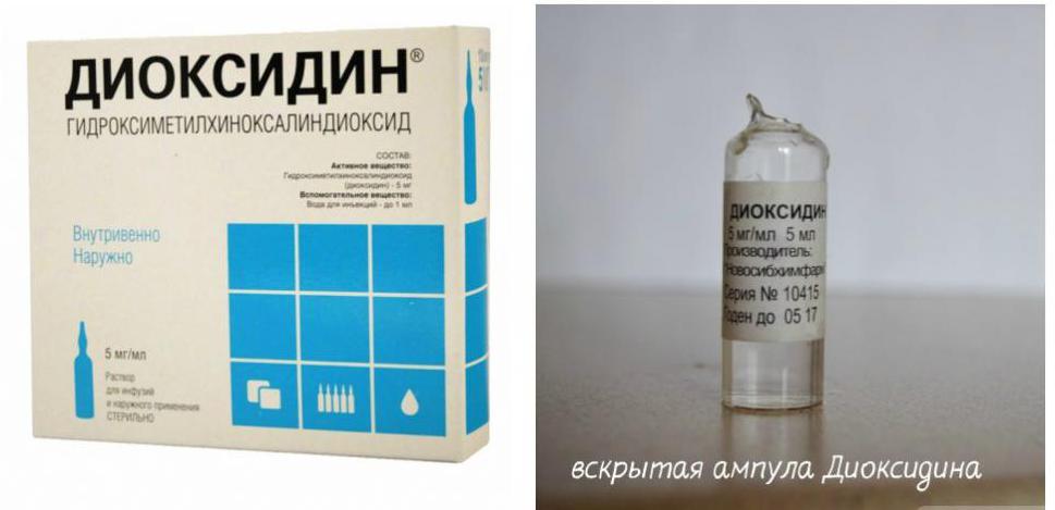 Диоксидин для ингаляций: когда применять, как дышать через небулайзер, цена за ампулы, аналоги препарат