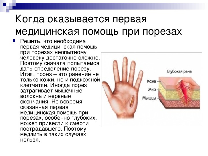 Что делать при порезе пальца? что делать, если ребёнок порезал палец? мануал для родителей правила оказания первой помощи при порезах.
