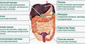 Кишечная колика симптомы и лечение у детей — proinfekcii.ru