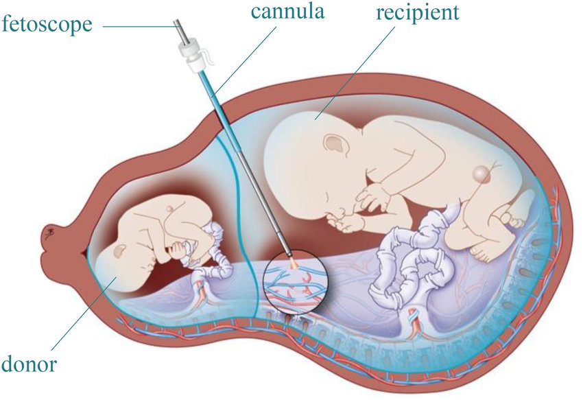 Как быстро нарастить эндометрий для зачатия при планировании беременности?