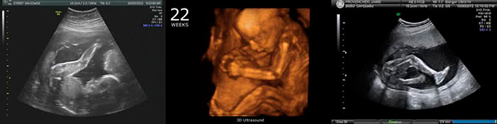 22 неделя беременности - фото малыша, ощущения, а также рекомендации будущей мамочке.