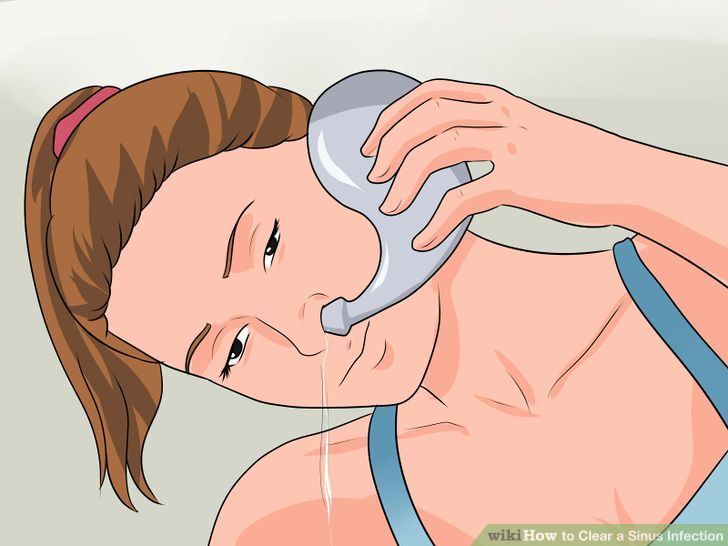 Как пробить нос без капель: быстро почистить от соплей в домашних условиях, открыть насморк при быстрой заложенности народными средствами