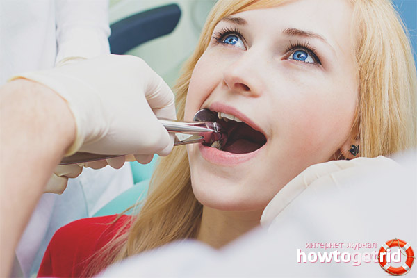 Лечение зубов при гв: можно ли проводить процедуры и допускается ли анестезия