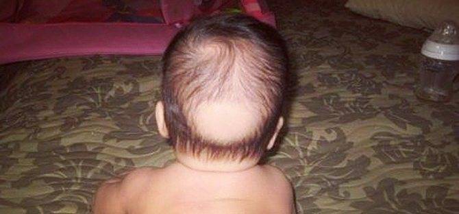 Почему у ребенка плохо растут волосы на голове, что делать плохо ростут волосы у грудника