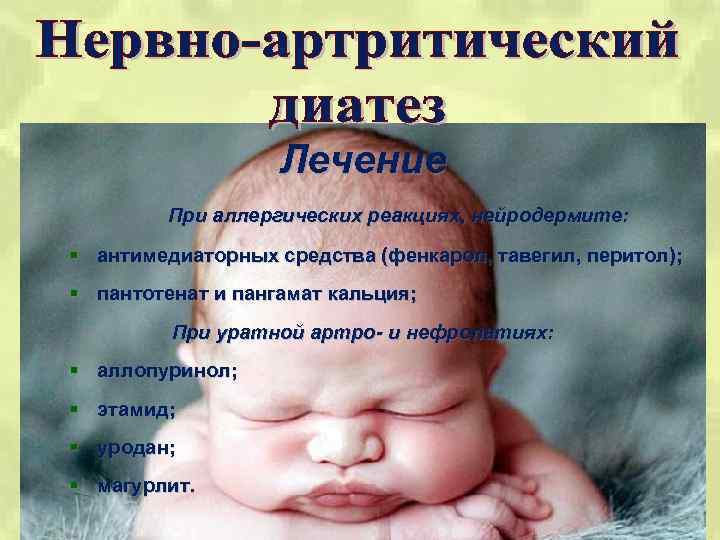 Нервно-артритический диатез у детей и взрослых: симптомы, диагностика и лечение | fok-zdorovie.ru