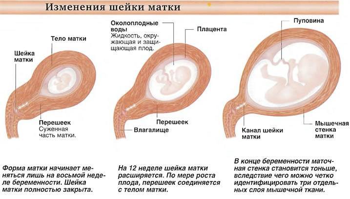 Матка при беременности - положение, размер, на ощупь мягкая или твердая