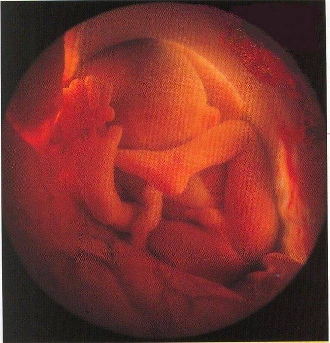 Узи на 13 неделе беременности (21 фото): размер плода, как выглядит ребенок, нормы и показатели