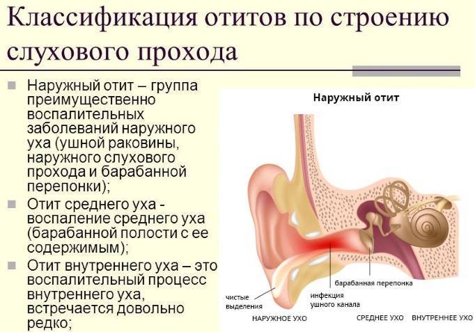 Буллезный отит фото