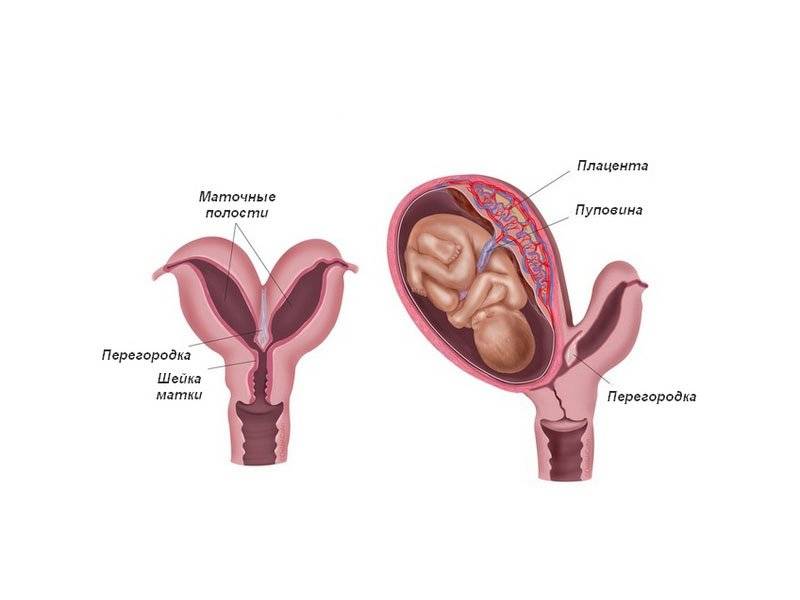 Седловидная матка: возможна ли беременность? что значит «матка седловидной формы»