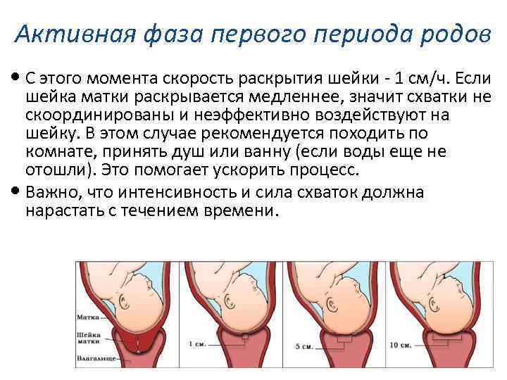 Подготовка шейки матки к родам: механические и медикаментозные методы