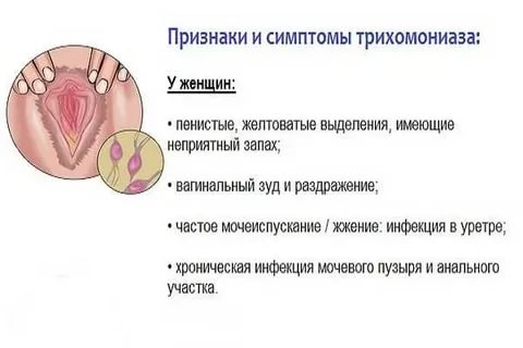 Диагностика и лечение трихомониаза в период беременности