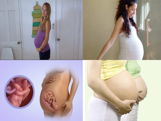 Когда рожать, если опустился живот: акушерский подход к предвестникам родов