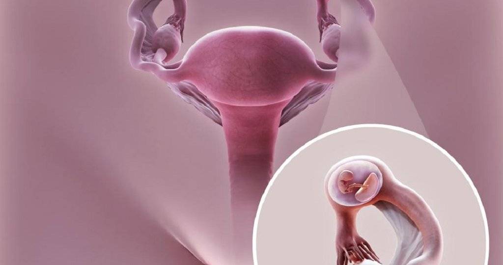 Спайки в малом тазу при беременности: причины формирования, симптомы, лечение и прогноз