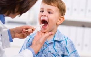 Лающий кашель у ребенка без температуры без насморка причины и лечение