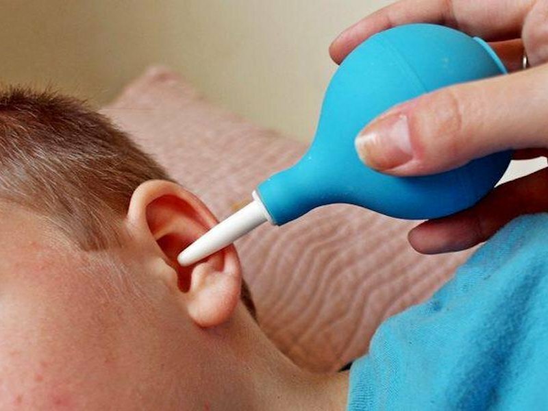 Как правильно чистить уши ребенку до года и старше от серы и других загрязнений?