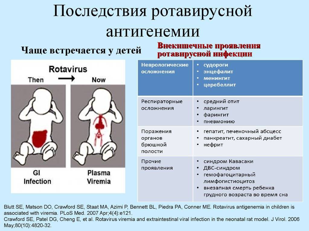 Симптомы ротавирусной инфекции у новорожденных и способы лечения заболевания у грудничков
