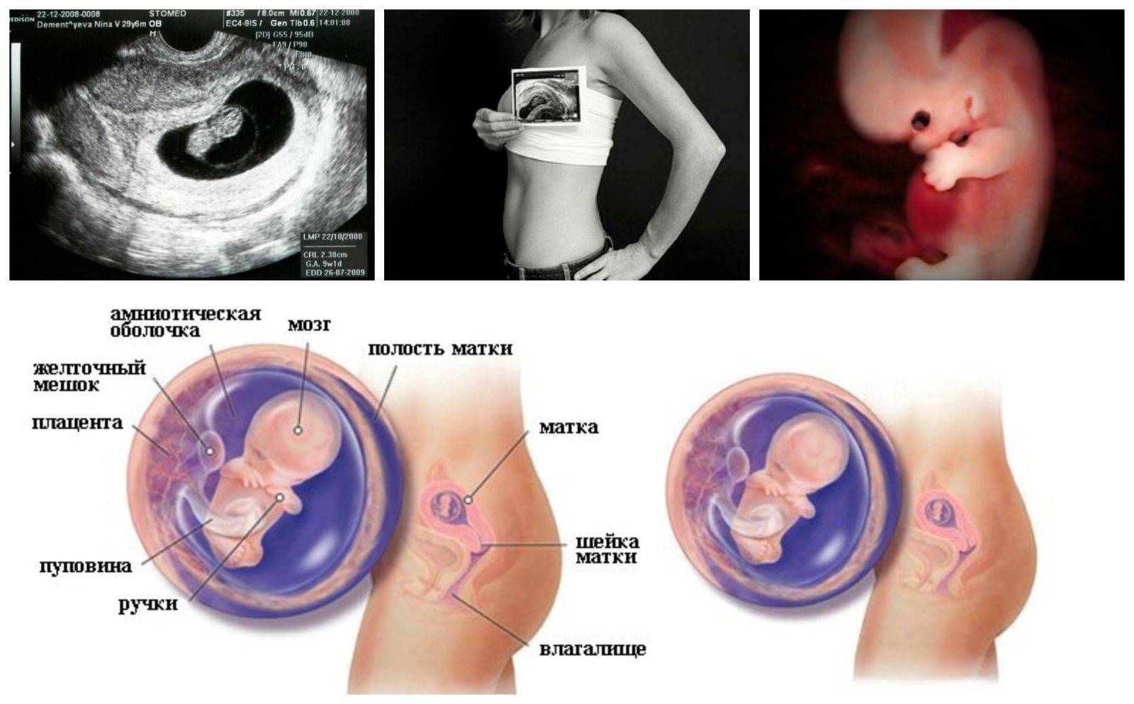 8 неделя беременности: признаки и ощущения женщины, симптомы, развитие плода