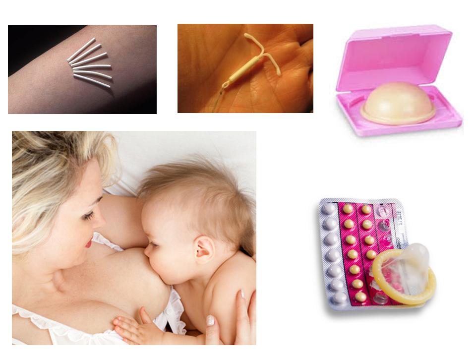 Какую спираль лучше поставить после родов - самый эффективный вид внутриматочной контрацепции