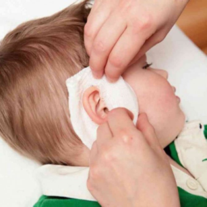 Камфорное масло: применение в ухо детям, инструкция, компресс при кашле, отзывы