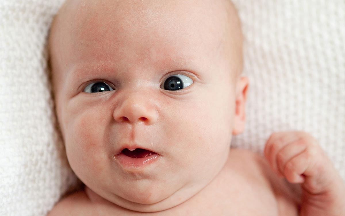 Почему у новорожденного косит один или оба глаза, и когда проходит косоглазие?
