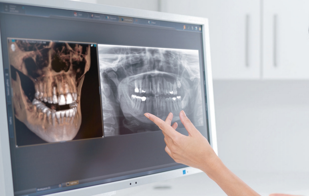 Рентгеновский снимок зуба в беременность