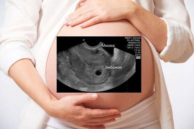 Планирование беременности при маленькой матке