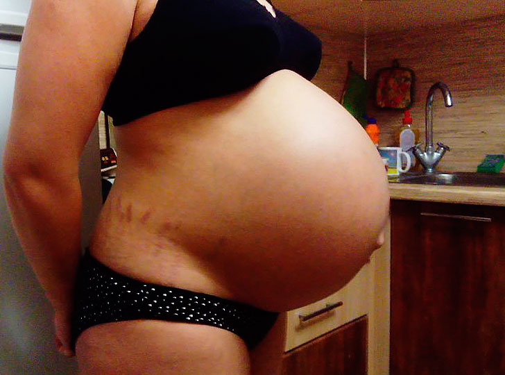 Запор на 38 неделе беременности