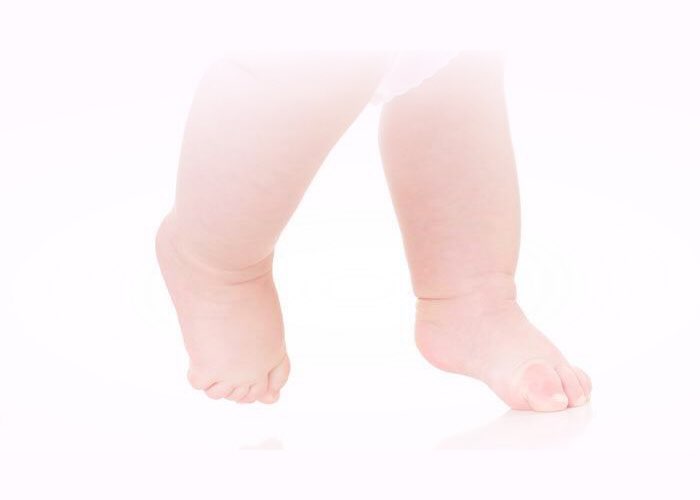 Ребенок ходит на носочках: причины и варианты решения проблемы