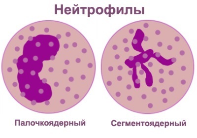 Нейтрофилы понижены у ребенка: о чем это говорит, симптомы и лечение отклонений