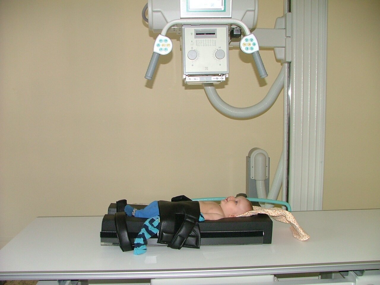 Рентген легких ребенку: назначение, подготовка, особенности обследования