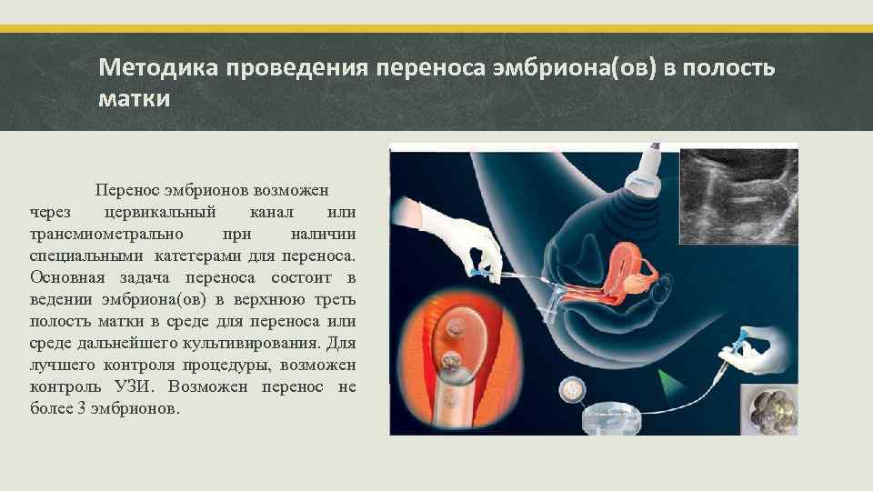 Перенос эмбрионов при эко: рекомендации до и после процедуры