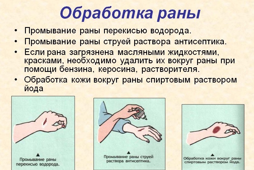 Как оказать первую помощь при ссадинах и потертостях ребенку и взрослому | lisa.ru