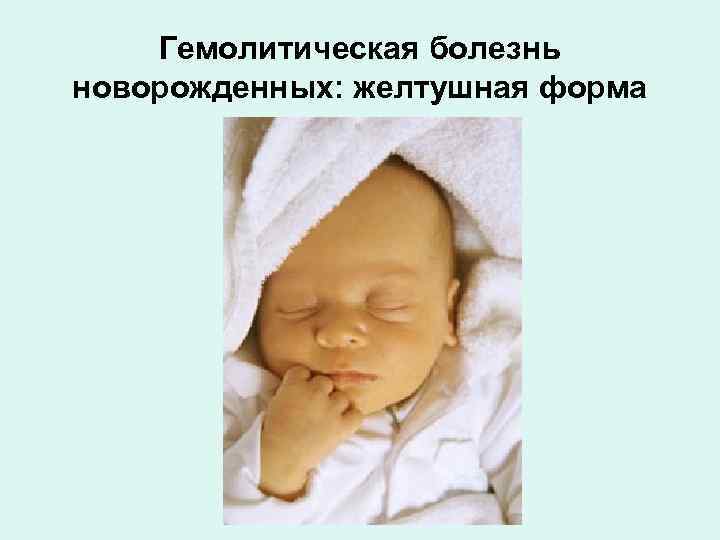 Причины гемолитической болезни у новорожденных, методы лечения и последствия