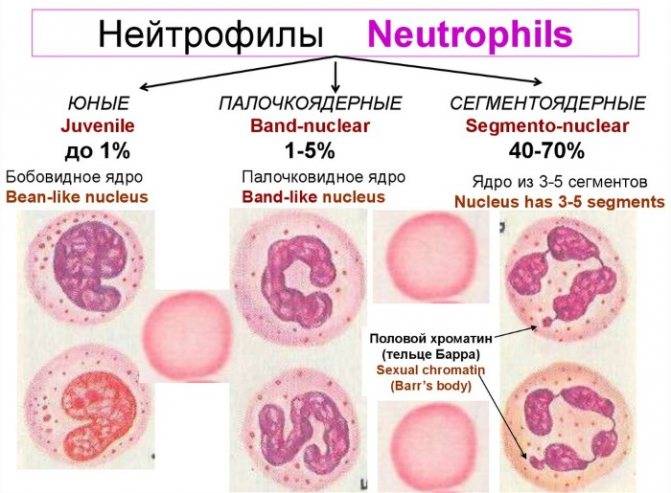 Основные причины повышения палочкоядерных нейтрофилов в крови у взрослого человека