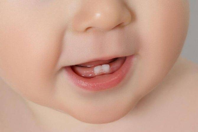 Во сколько месяцев режутся зубки у мальчиков: симптомы появления