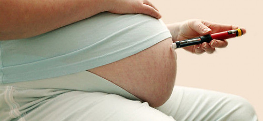 Роды при гестационном диабете 1 и 2 типов: можно ли рожать