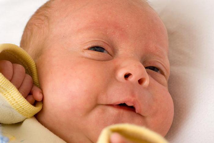 Почему у ребенка открыты глаза во время сна