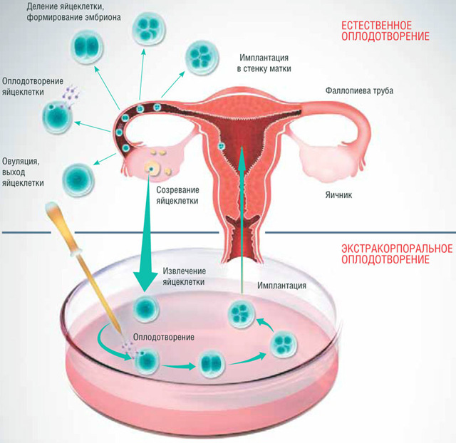Как можно улучшить кровоток в матке при планировании беременности и перед переносом эмбрионов для эко?