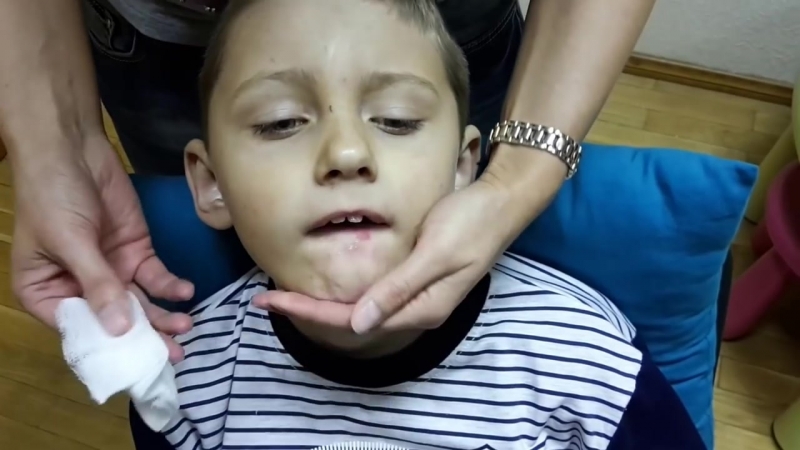 Как правильно делать логопедический массаж для детей с проблемами речи?